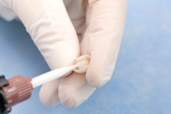 TopCEM Dual Cure Resin Cement - Image 2