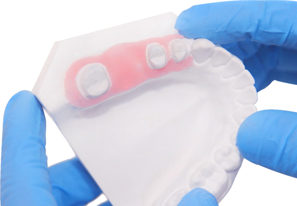 A-Silicone for Gingival Mask - Image 5